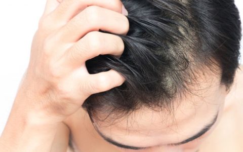 头皮上经常长疙瘩和脓包，是怎么了？这4个建议听一听！